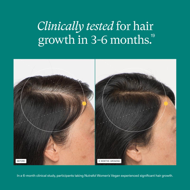Nutrafol Women's Hair Growth Supplements, For Women 18-44 Years Old, Clinically Tested for Visibly Thicker, Stronger Hair, 100% Vegan Ingredients, Dermatologist Recommended - 2 Month Supply, 2 Pouches - Image 4